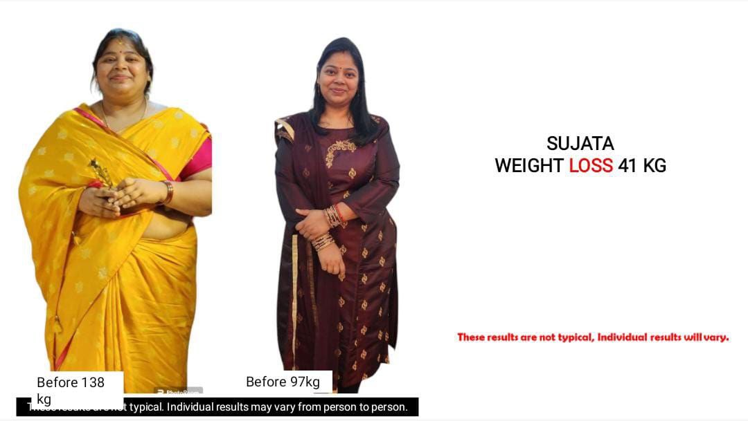 Before-and-after transformation shared by Smiling Transformations community member 10