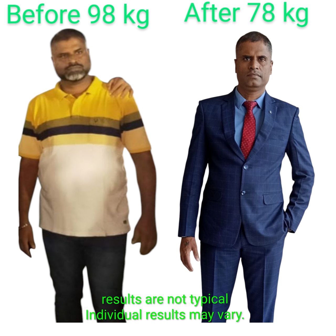 Before-and-after transformation shared by Smiling Transformations community member 7